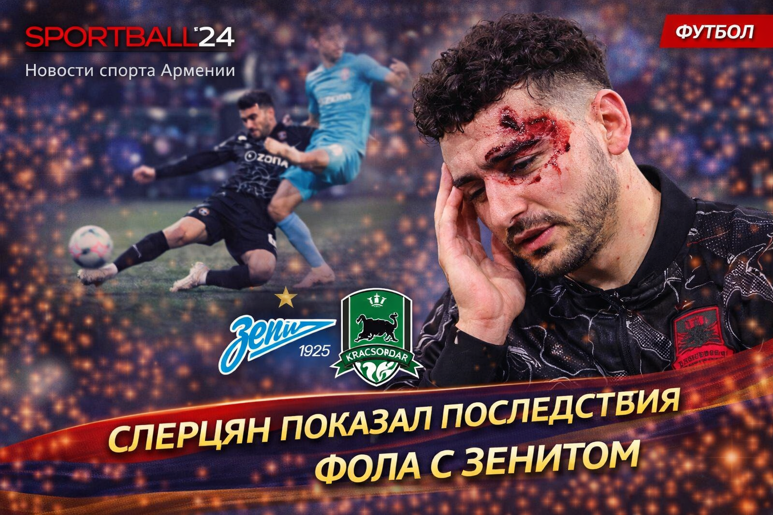 Сперцян показал последствия фола с Зенитом